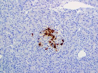 IHC of Somatostatin on an FFPE Pancreas Tissue